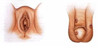 Obat Sipilis Banyumas Kabupaten Banyumas Jawa Tengah